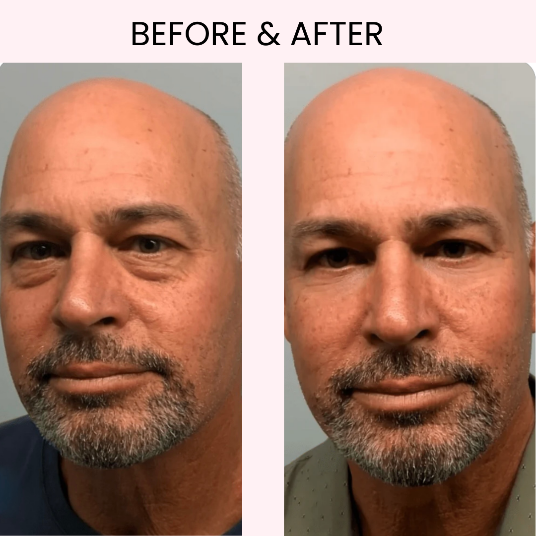 LUMIARA™ Radiance Retinol Stick: The Ultimate Brightening & Anti-Aging Eye Treatment
