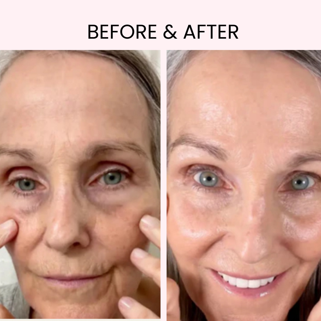 LUMIARA™ Radiant Eye: Professional LED & EMS Therapy
