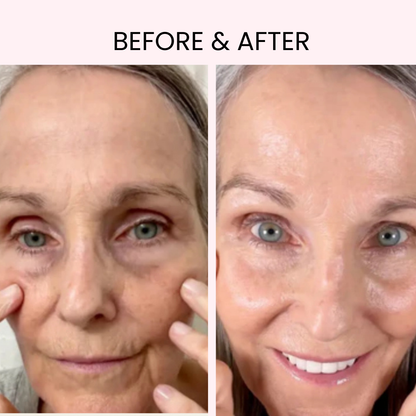 LUMIARA™ Radiant Eye: Professional LED & EMS Therapy