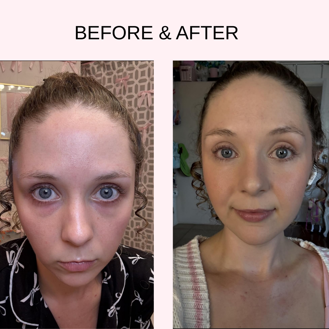 LUMIARA™ Radiant Eye: Professional LED & EMS Therapy