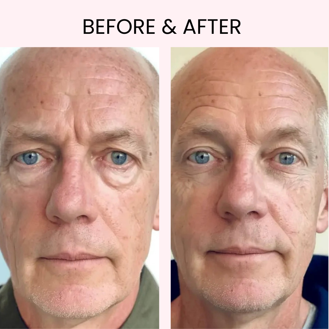LUMIARA™ Radiant Eye: Professional LED & EMS Therapy